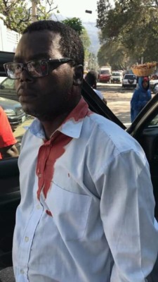 Haïti - Incidents à l'ENS: 2 professeurs blessés, un étudiant arrêté par les hommes armés de Jovenel Moïse 1