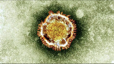 Coronavirus: 43 cas confirmés, Pétion-ville et Delmas les plus touchées 1